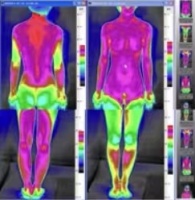 可喜安治疗仪释放红外线 加速血液循环活化组织细胞