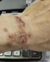 比甲醛还毒的装修致癌物，一定要小心