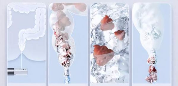 韩国智能马桶盖