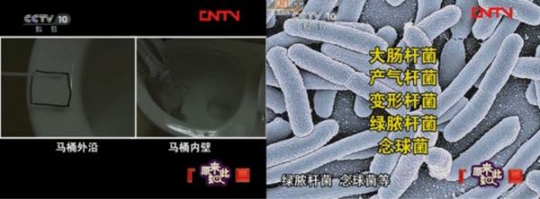 Antibacterial Design of Smart Toilets
